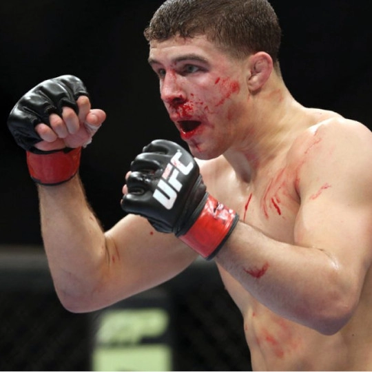 Alexander Jay Iaquinta Raging